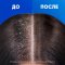 Шампунь для волос «Head&Shoulders» 3 Action, ментол, 400 мл
