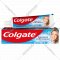 Зубная паста «Colgate» Бережное отбеливание, 100 мл.